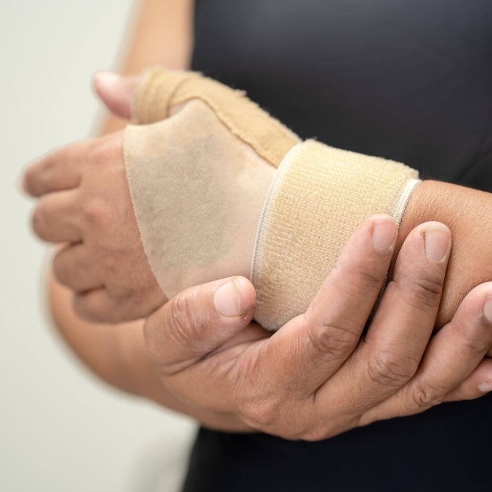 Photo of Wrist and thumb splint for management of De Quervain Syndrome